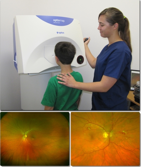optomap retinal imaging